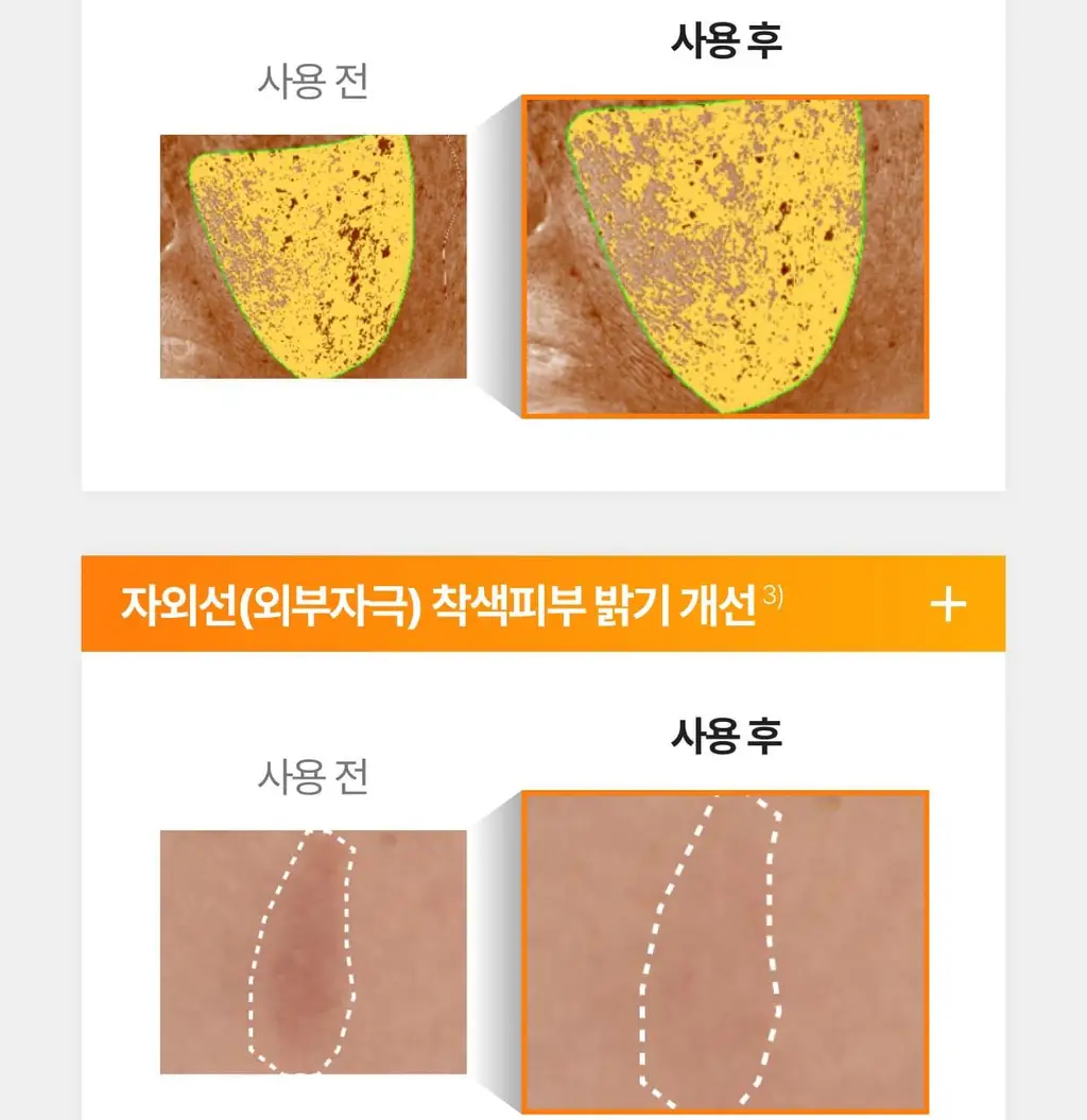 [흔적,기미,미백/TXA] 셀리맥스 트라넥삼산 잡티 크림 35ml 상세페이지 18